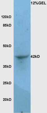 LAMP-1 Antibody in Western Blot (WB)