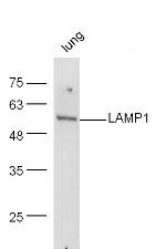 LAMP-1 Antibody in Western Blot (WB)