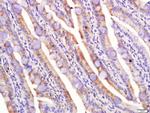 LPL Antibody in Immunohistochemistry (Paraffin) (IHC (P))