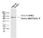 RBCK1 Antibody in Western Blot (WB)