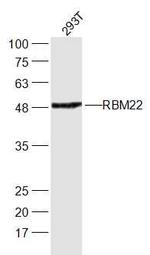 RBM22 Antibody in Western Blot (WB)