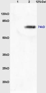 MASP2 Antibody in Western Blot (WB)