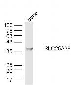 SLC25A38 Antibody in Western Blot (WB)