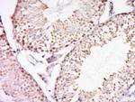 REV3L Antibody in Immunohistochemistry (Paraffin) (IHC (P))