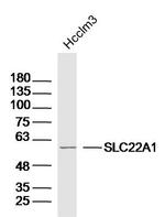 SLC22A1 Antibody in Western Blot (WB)
