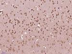 Phospho-Src (Ser75) Antibody in Immunohistochemistry (Paraffin) (IHC (P))