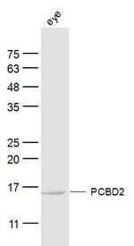 PCBD2 Antibody in Western Blot (WB)
