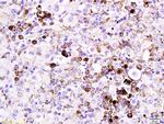 MITF Antibody in Immunohistochemistry (Paraffin) (IHC (P))