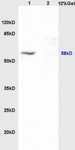 MITF Antibody in Western Blot (WB)