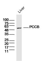 PCCB Antibody in Western Blot (WB)