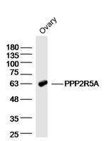 PPP2R5A Antibody in Western Blot (WB)