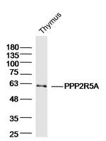 PPP2R5A Antibody in Western Blot (WB)