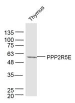 PPP2R5E Antibody in Western Blot (WB)