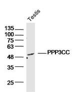 PPP3CC Antibody in Western Blot (WB)