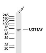 UGT1A7 Antibody in Western Blot (WB)