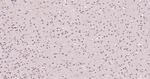 Phospho-FoxO1 (Ser319) Antibody in Immunohistochemistry (Paraffin) (IHC (P))