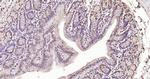 Phospho-FoxO1 (Ser319) Antibody in Immunohistochemistry (Paraffin) (IHC (P))