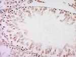 RanBP3 Antibody in Immunohistochemistry (Paraffin) (IHC (P))