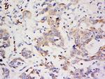 ZNF703 Antibody in Immunohistochemistry (Paraffin) (IHC (P))