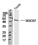 SOCS7 Antibody in Western Blot (WB)