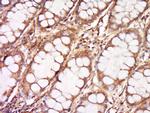DNCLI1 Antibody in Immunohistochemistry (Paraffin) (IHC (P))