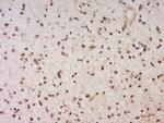 EYA1 Antibody in Immunohistochemistry (Paraffin) (IHC (P))