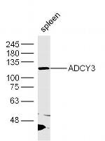 ADCY3 Antibody in Western Blot (WB)