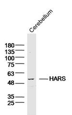 HARS Antibody in Western Blot (WB)