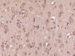 TRIM23 Antibody in Immunohistochemistry (Paraffin) (IHC (P))