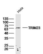 TRIM23 Antibody in Western Blot (WB)