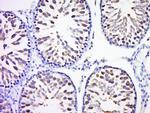 Rad51 Antibody in Immunohistochemistry (Paraffin) (IHC (P))