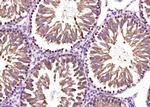 Rad51 Antibody in Immunohistochemistry (Paraffin) (IHC (P))