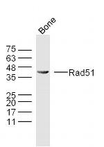 Rad51 Antibody in Western Blot (WB)