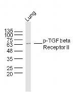 Phospho-TGF beta Receptor II (Ser225) Antibody in Western Blot (WB)