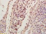 LIS1 Antibody in Immunohistochemistry (Paraffin) (IHC (P))