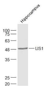 LIS1 Antibody in Western Blot (WB)