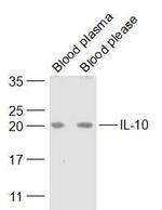 IL-10 Antibody in Western Blot (WB)
