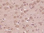 VEGFA Antibody in Immunohistochemistry (Paraffin) (IHC (P))