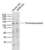 Thrombomodulin Antibody in Western Blot (WB)