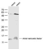 ANP Antibody in Western Blot (WB)