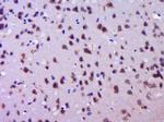 Tau Antibody in Immunohistochemistry (Paraffin) (IHC (P))