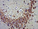 Tau Antibody in Immunohistochemistry (Paraffin) (IHC (P))