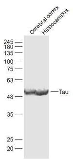 Tau Antibody in Western Blot (WB)