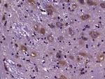 Tau Antibody in Immunohistochemistry (Paraffin) (IHC (P))