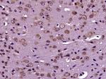 Tau Antibody in Immunohistochemistry (Paraffin) (IHC (P))