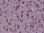 Tau Antibody in Immunohistochemistry (Paraffin) (IHC (P))
