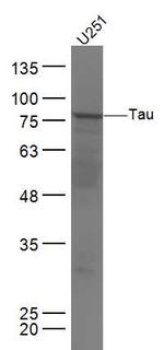 Tau Antibody in Western Blot (WB)