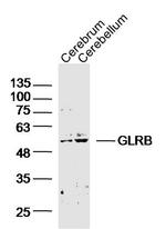 GLRB Antibody in Western Blot (WB)