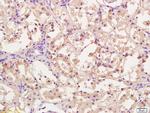 CPT1A Antibody in Immunohistochemistry (Paraffin) (IHC (P))