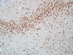 AKT2 Antibody in Immunohistochemistry (Paraffin) (IHC (P))